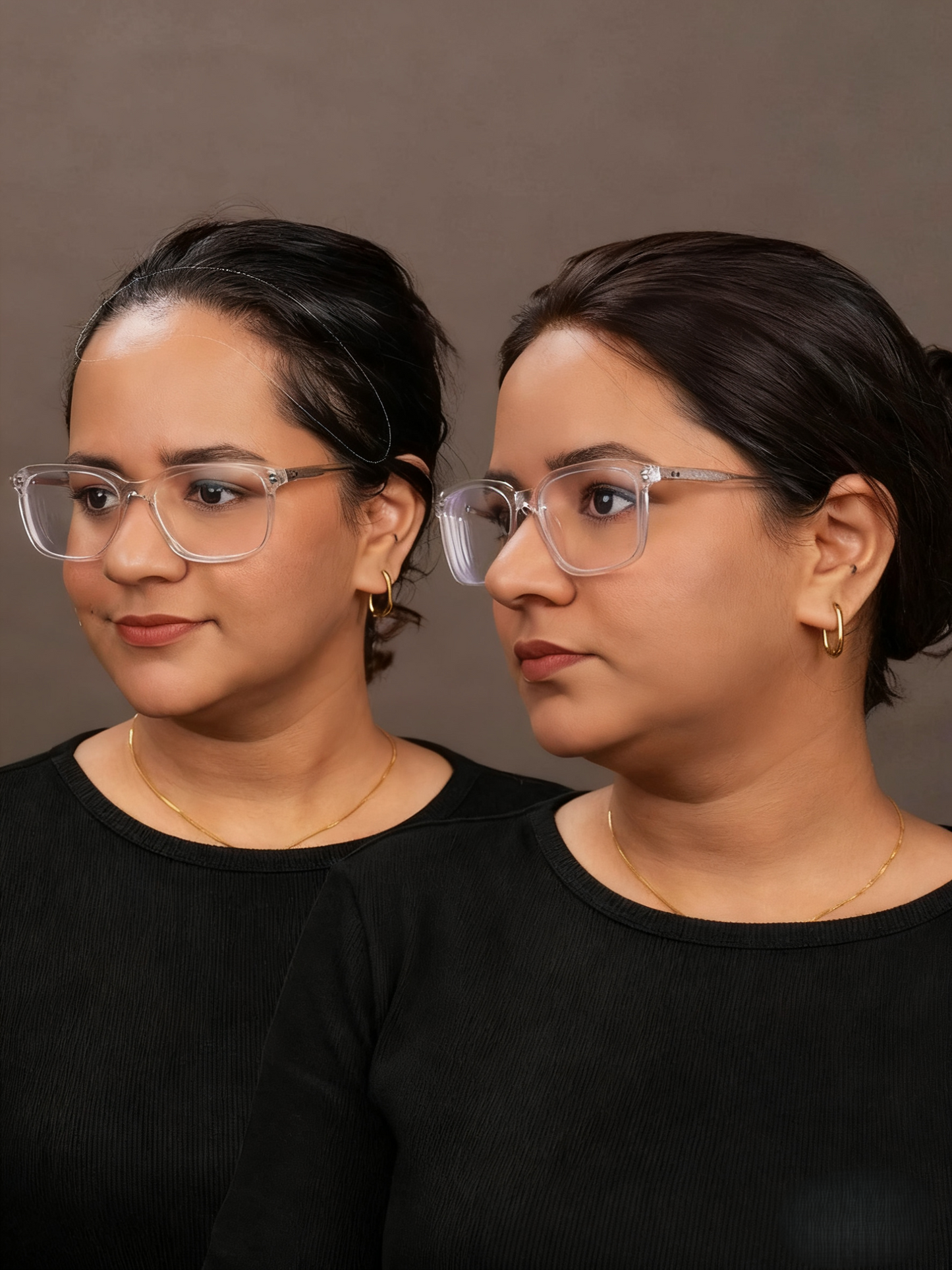 🔥Front Hairline Topper for Receding Hairline